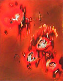 Microbes Exposed XIX